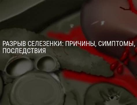 Последствия разрыва селезенки