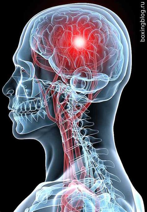 Последствия удара в висок: что происходит и как их предотвратить