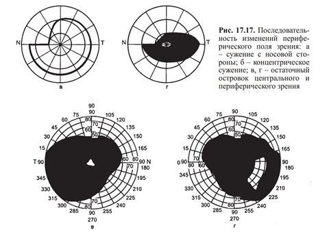 Постепенное сужение поля зрения