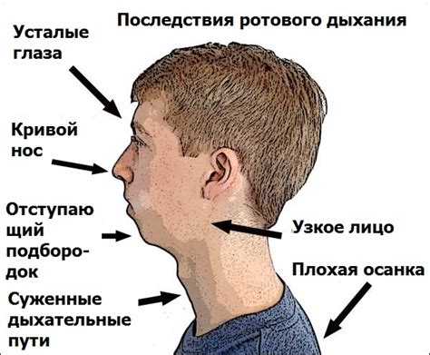 Постоянное дыхание через рот