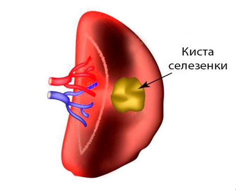 Потенциальные проблемы с глюкозой