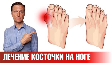 Почему натираются ботинки на косточке?