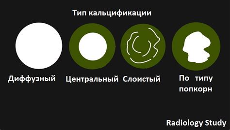 Почему образуются узлы на легких?