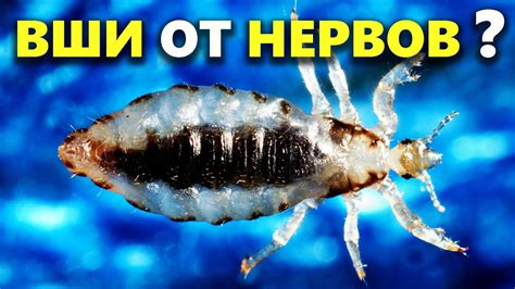 Появление вшей от нервов – миф или реальность?