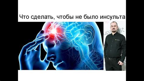 Прединсультное состояние: методы лечения и профилактика