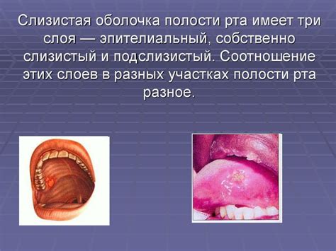 Предотвращение повреждений слизистой оболочки