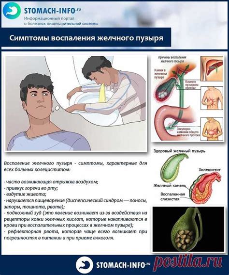 Предупреждение воспаления желчного пузыря без камней