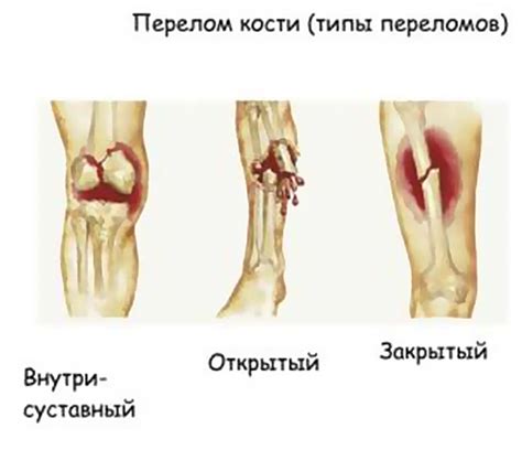 Признаки серьезной травмы при ударе затылком