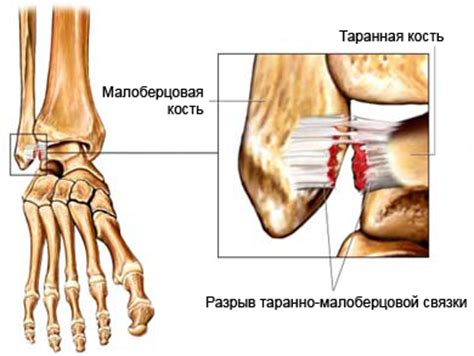 Применение междуфразовых связок