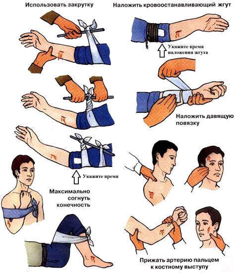 Применение стерильных повязок для остановки кровотечения