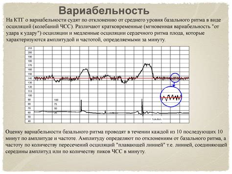 Примеры использования НСТ реактивного при КТГ