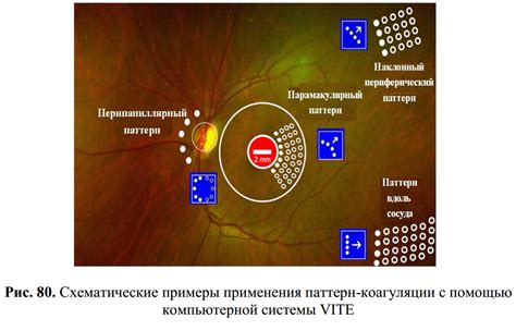 Примеры применения коагуляции, синерезиса и эмульсионной полимеризации