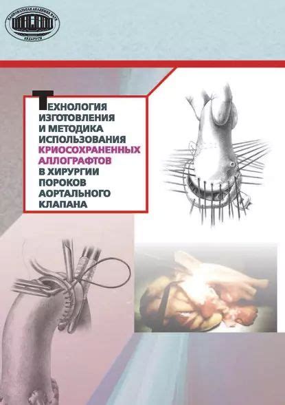 Принципы использования зонта в хирургии