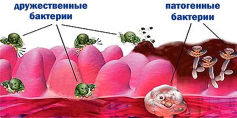 Принципы лечения Streptococcus mitis у мужчин