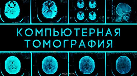 Принцип работы компьютерной томографии головного мозга