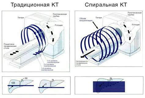 Принцип работы мультиспиральной компьютерной томографии