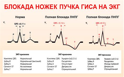 Причины блокады ноги по Гизу