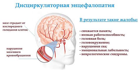 Причины возникновения ДЭП 2 степени