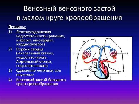 Причины возникновения венозного застоя в легких