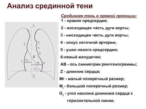 Причины возникновения кардио-диафрагмальных синусов