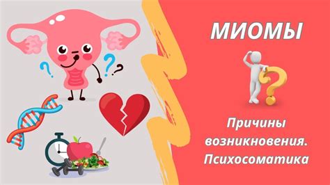 Причины возникновения миомы