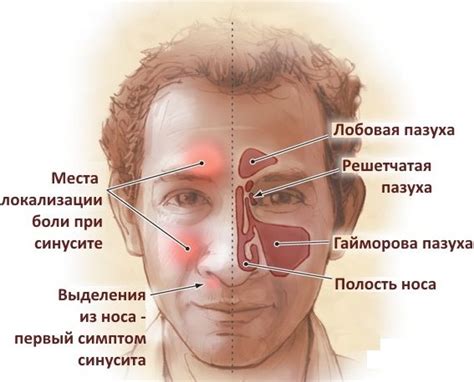 Причины возникновения носовых заболеваний