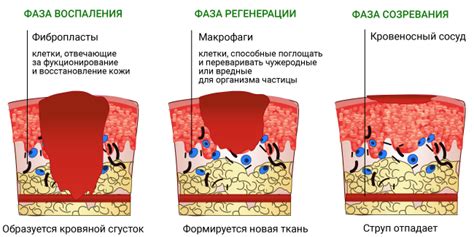 Причины возникновения ожога