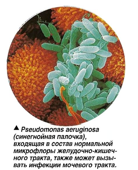 Причины возникновения Pseudomonas aeruginosa