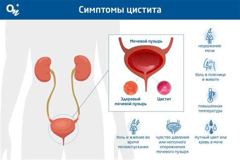 Причины воспаления мочевого пузыря у мужчин