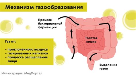 Причины газообразования в желудке и кишечнике