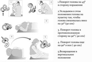 Причины головокружения головного мозга