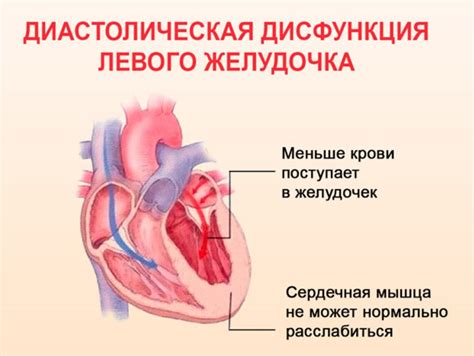 Причины диффузных изменений миокарда левого желудочка (ЛЖ)