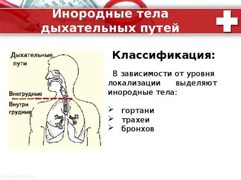 Причины задерживания леденца в дыхательных путях