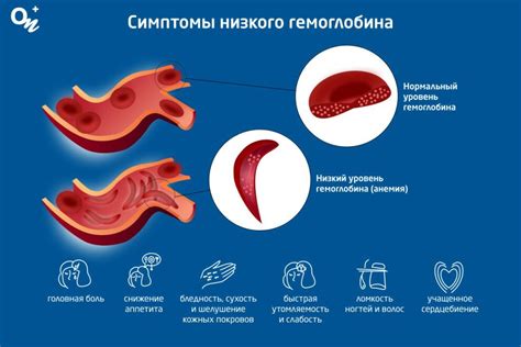 Причины и симптомы низкого гемоглобина