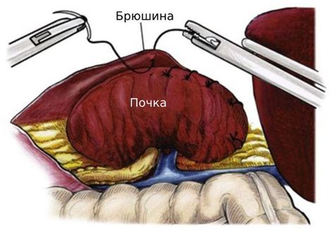 Причины и симптомы проблем с панцирём у улиток