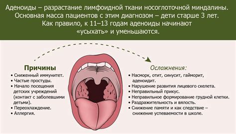 Причины и симптомы увеличения миндалин у ребенка