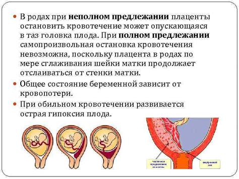 Причины низкой плацентации на 20 неделе беременности