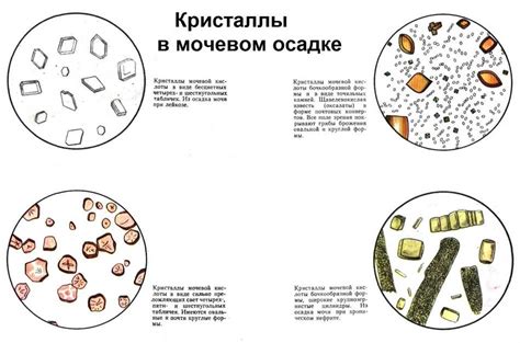 Причины образования кристаллов в моче