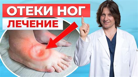 Причины опухания ноги после укуса: что делать?