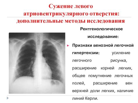 Причины повторных прохождений флюорографии