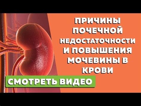 Причины повышения уровня мочевины