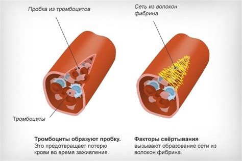 Причины повышения уровня сои в крови