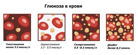 Причины повышенного уровня глюкозы 6.1 в крови