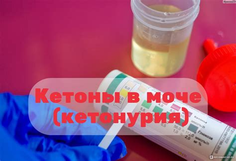 Причины появления кетонов в моче