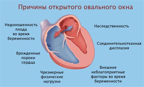 Причины появления открытого овального окна