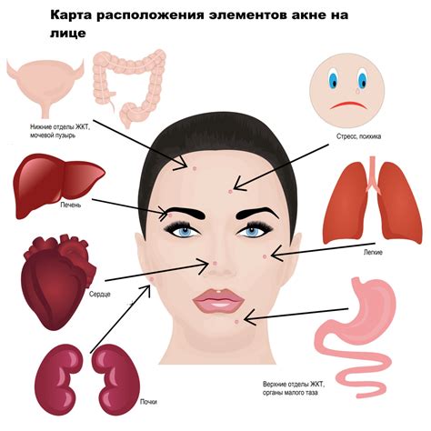 Причины появления прыщей на лице