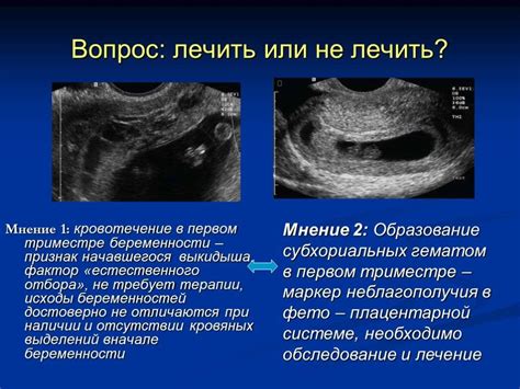 Причины преждевременной зрелости плаценты