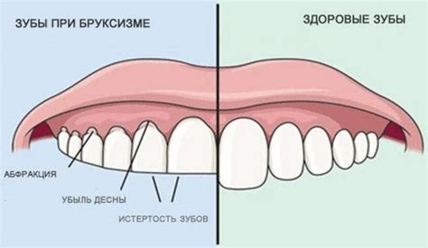 Причины прикусывания языка во сне