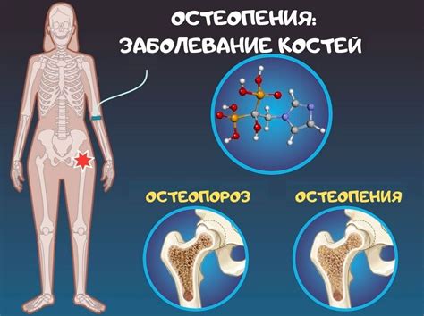 Причины сохранности костей в автомобиле