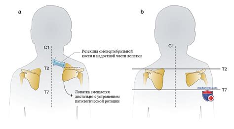 Причины стояния на месте ребенка